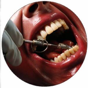 Jedlý papier pacient u zubára 19,5 cm - Pictu Hap